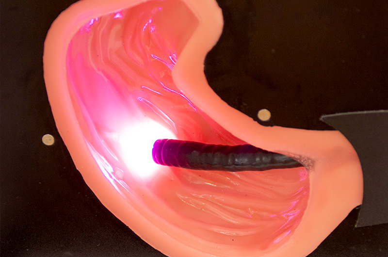 胃がんなどの病気の早期発見に有効です